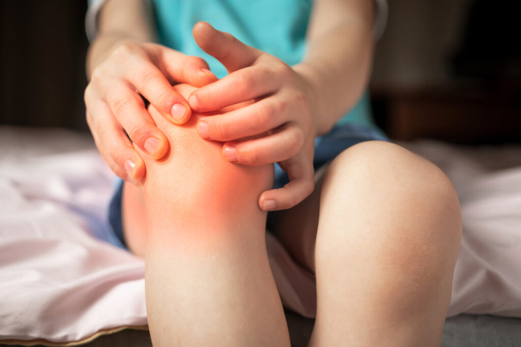 Młodzieńcze idiopatyczne zapalenie stawów - dziecko trzymająca się za zaczerwienione kolano.